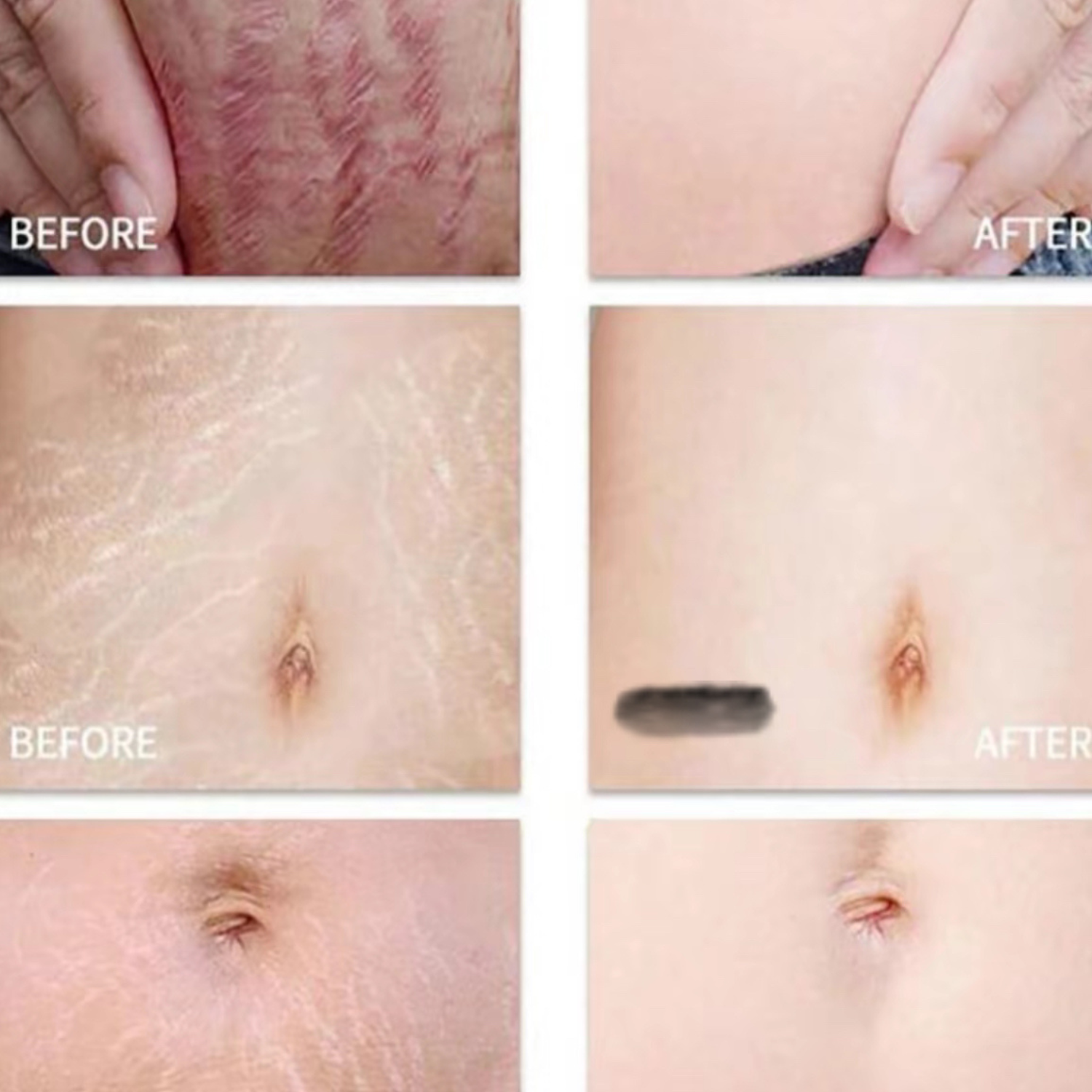 Stretch Mark Glow Body Oil