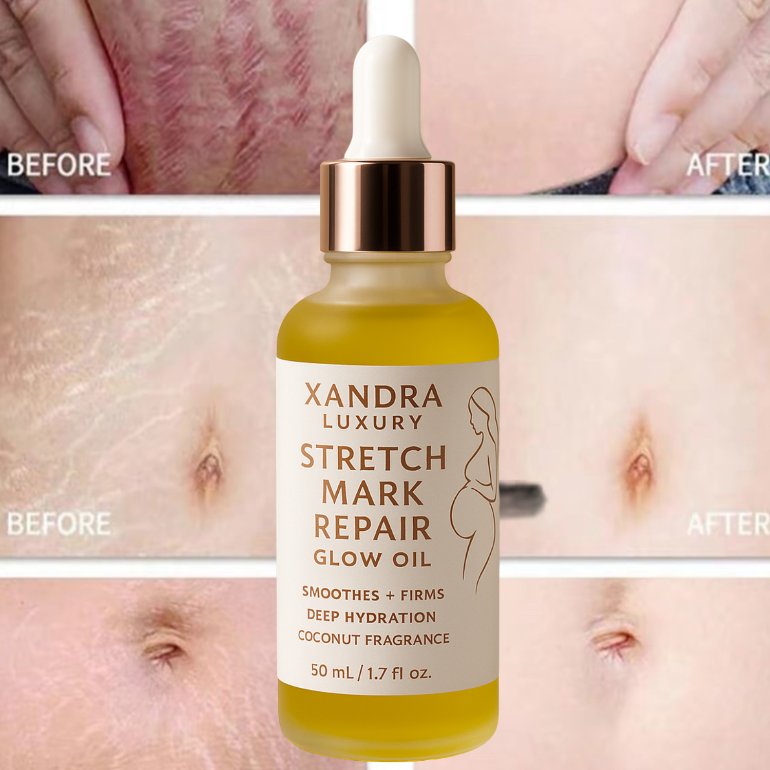Stretch Mark Glow Body Oil